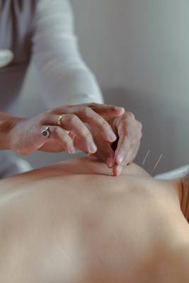 Eine Person, die eine Akupunkturbehandlung im Amatara Welleisure Resort durchführt.